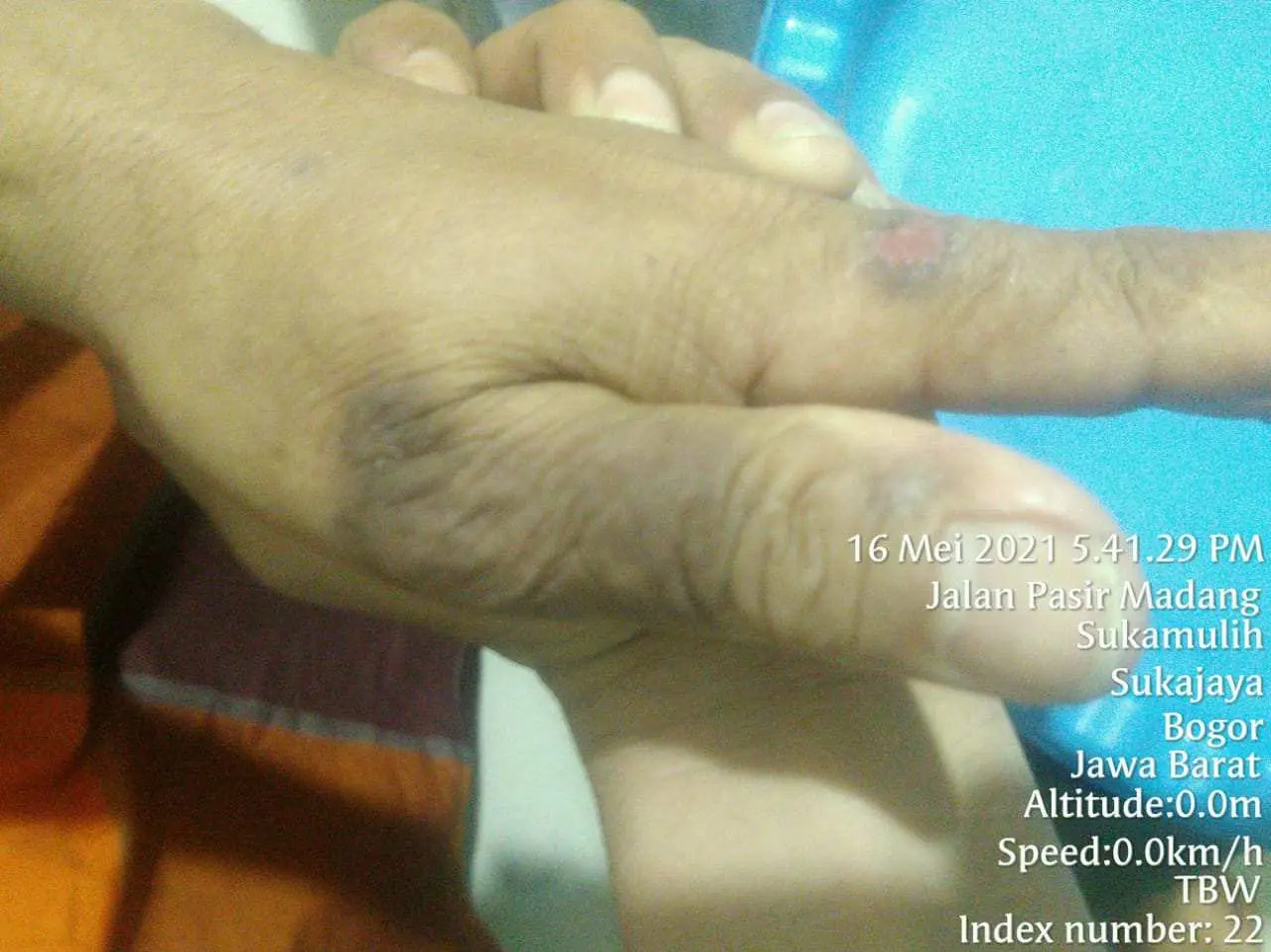 Terkait Dugaan Malpraktek Oknum Dokter MC, Aktivis Bogor Raya Minta IDI Turun Tangan